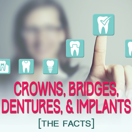 Crowns, Bridges, Dentures, and Implants: The Facts