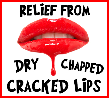 dry chapped lips