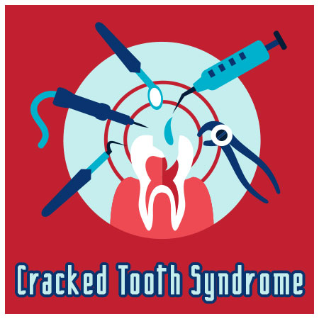 Crack Down on Cracked Tooth Syndrome