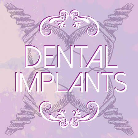 4 Facts about Dental Implants