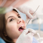 What is an Oral Cancer Screening?