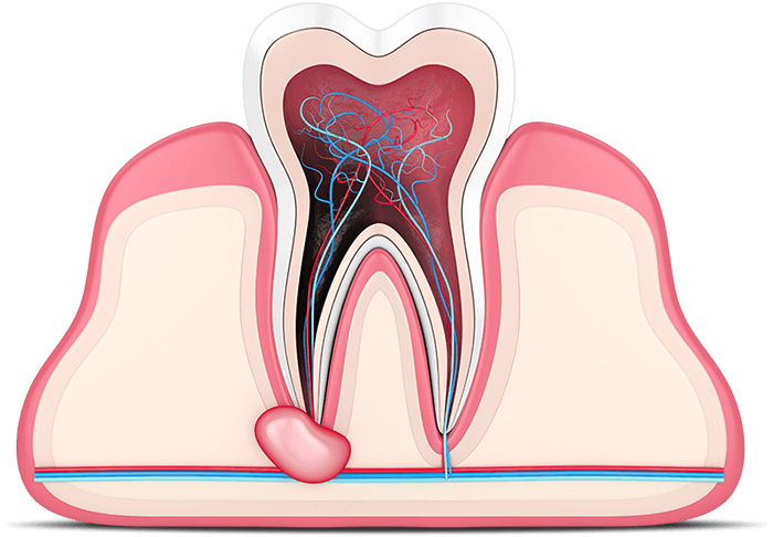 tooth graphic