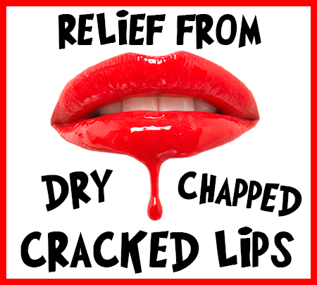 cracked lips