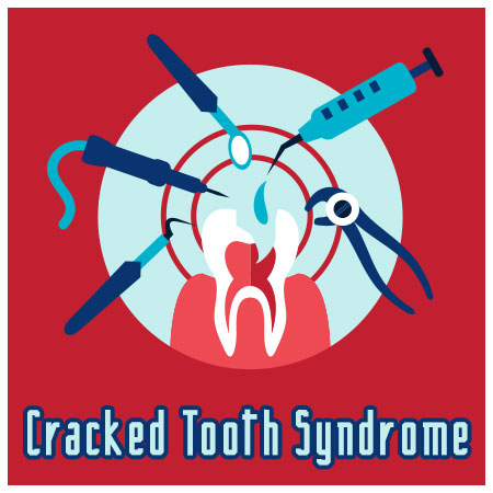 cracked tooth