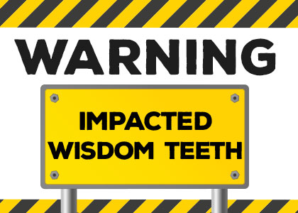 impacted wisdom teeth