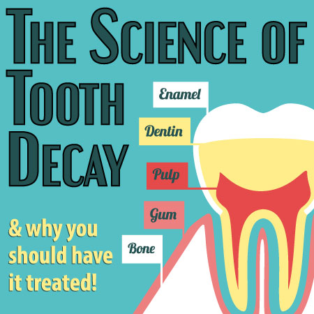 tooth decay