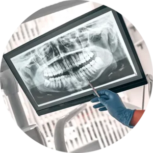 dental xray