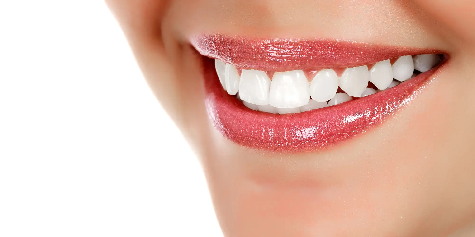 smile white