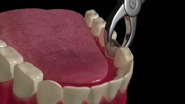 pain relief2