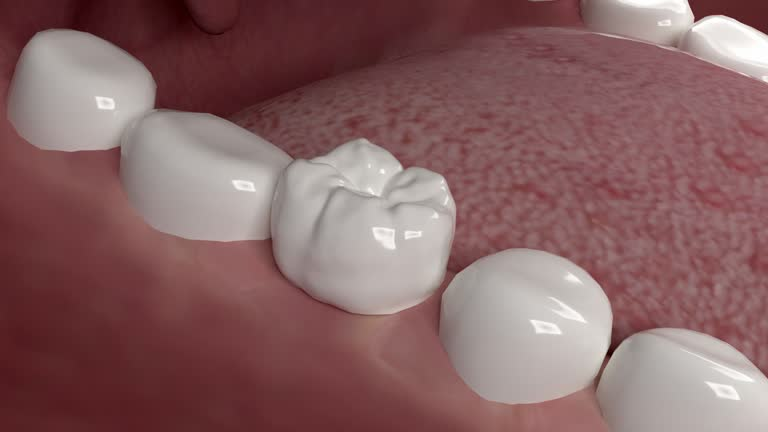 a digital image showing a tooth with a crown