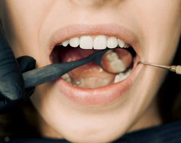 photo showing the inside of a person's mouth