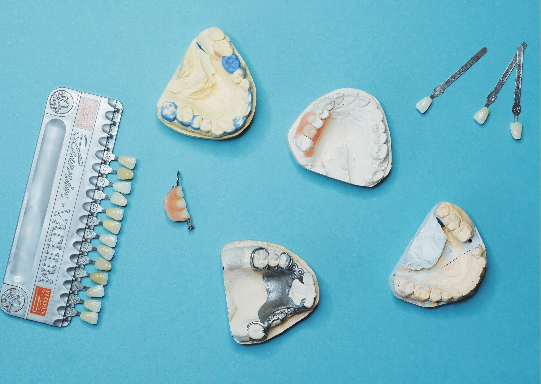 Dental models, shade guides, and restoration samples used to explain the differences between bonding and veneers during treatment planning.